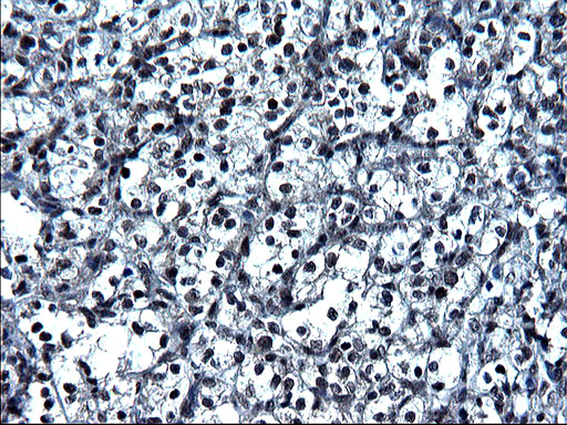 m16734 anti zfand3 mouse monoclonal antibody clone id oti1h10 ihc testing 11