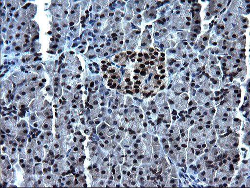 Immunohistochemical staining of paraffin-embedded Human pancreas tissue within the normal limits using anti-ZFAND3 mouse monoclonal antibody