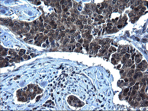 m16734 anti zfand3 mouse monoclonal antibody clone id oti1h10 ihc testing 7