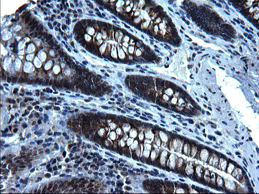 m16734 anti zfand3 mouse monoclonal antibody clone id oti1h10 ihc testing 9