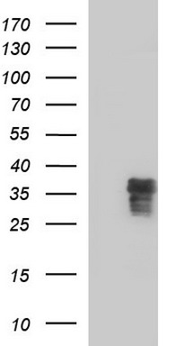 HEK293T cells were transfected with the pCMV6-ENTRY control (Left lane) or pCMV6-ENTRY ZFAND3 (Right lane) cDNA for 48 hrs and lysed