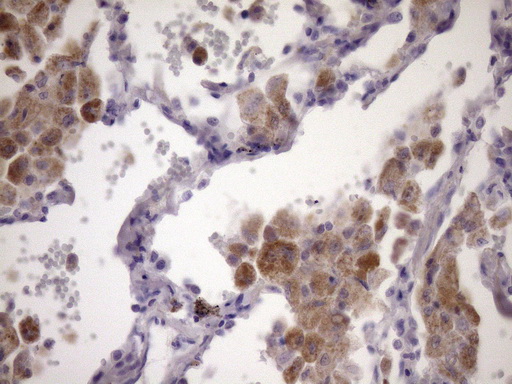 m16740 anti pcdhgc5 mouse monoclonal antibody clone id oti2e1 ihc testing 2