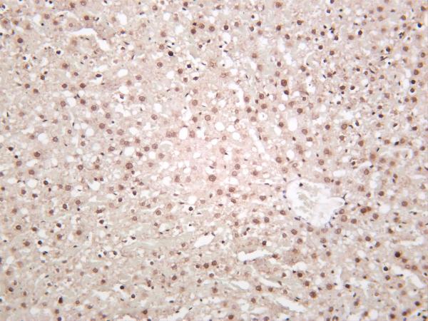 m16777 6 hist1h2ab primary antibodies ihc testing 1