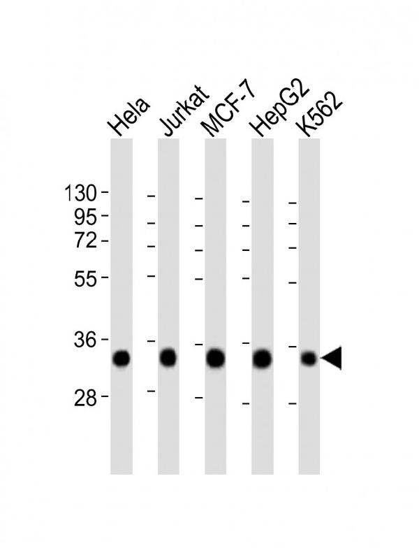 All lanes : Anti-HNRNPA1L2 Antibody (N-Term) at 1:2000 dilution Lane 1: Hela whole cell lysate Lane 2: Jurkat whole cell lysate Lane 3: MCF-7 whole cell lysate Lane 4: HepG2 whole cell lysate Lane 5: K562 whole cell lysate Lysates/proteins at 20 microg per lane. Secondary Goat Anti-Rabbit IgG, (H+L), Peroxidase conjugated at 1/10000 dilution. Predicted band size : 34 kDa Blocking/Dilution buffer: 5% NFDM/TBST.
