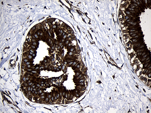 Immunohistochemical staining of paraffin-embedded Human breast tissue within the normal limits using anti-RNASE11 mouse monoclonal antibody. (Heat-induced epitope retrieval by 1mM EDTA in 10mM Tris buffer (pH8.5) at 120°C for 3min