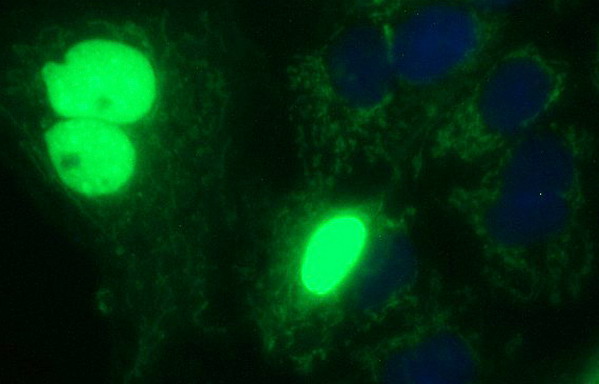 m17067 anti polr3gl mouse monoclonal antibody clone id oti5e8 if testing 22