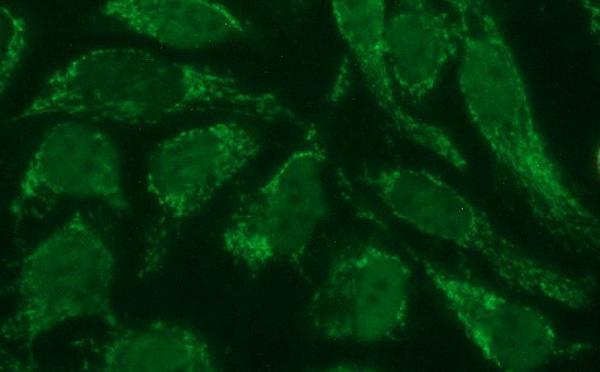 m17067 anti polr3gl mouse monoclonal antibody clone id oti5e8 if testing 23