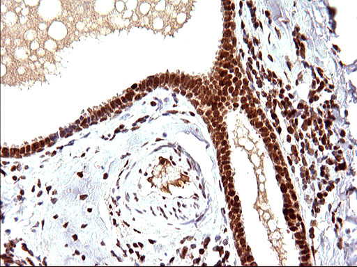 m17067 anti polr3gl mouse monoclonal antibody clone id oti5e8 ihc testing 10