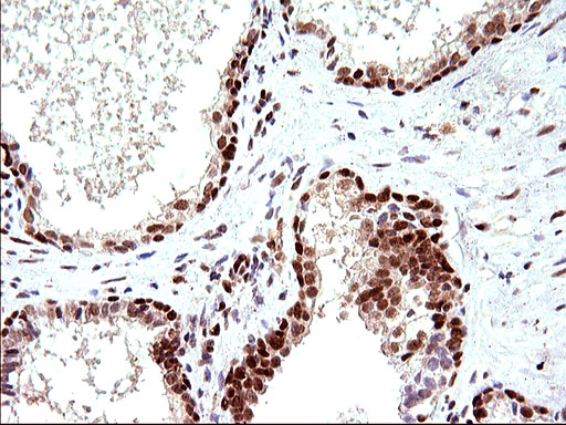 m17067 anti polr3gl mouse monoclonal antibody clone id oti5e8 ihc testing 11