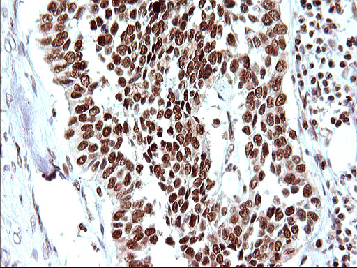 m17067 anti polr3gl mouse monoclonal antibody clone id oti5e8 ihc testing 12