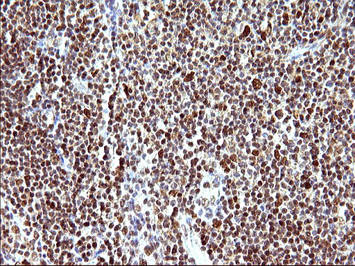 m17067 anti polr3gl mouse monoclonal antibody clone id oti5e8 ihc testing 13