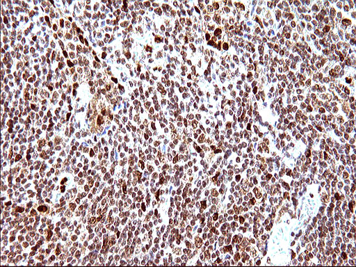 m17067 anti polr3gl mouse monoclonal antibody clone id oti5e8 ihc testing 14