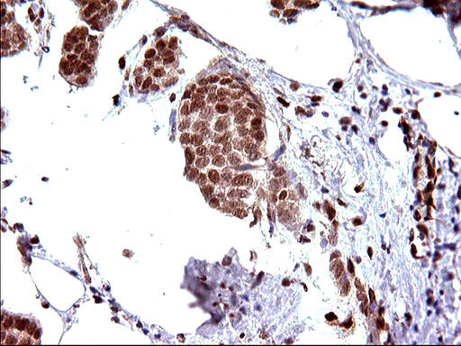 m17067 anti polr3gl mouse monoclonal antibody clone id oti5e8 ihc testing 15