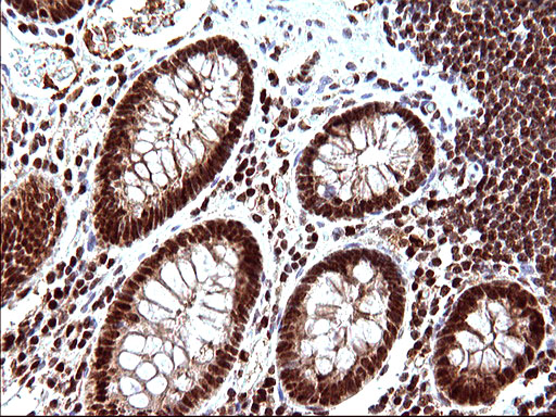 m17067 anti polr3gl mouse monoclonal antibody clone id oti5e8 ihc testing 16