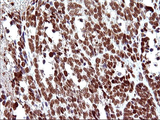m17067 anti polr3gl mouse monoclonal antibody clone id oti5e8 ihc testing 17
