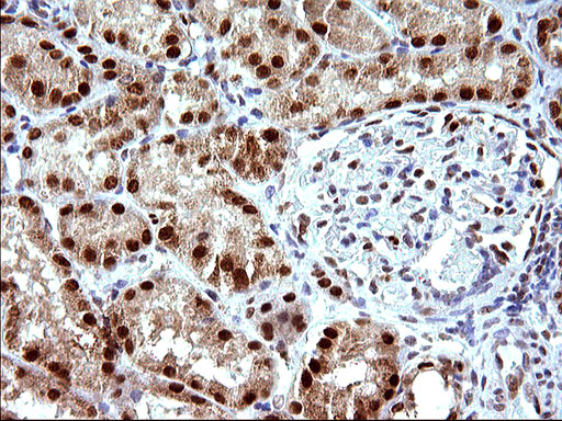 m17067 anti polr3gl mouse monoclonal antibody clone id oti5e8 ihc testing 18