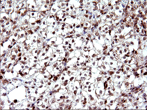 m17067 anti polr3gl mouse monoclonal antibody clone id oti5e8 ihc testing 19