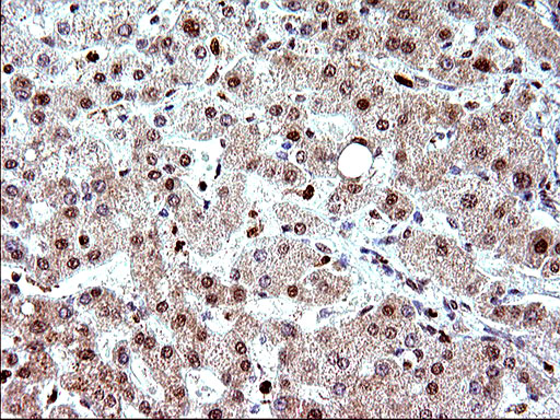 m17067 anti polr3gl mouse monoclonal antibody clone id oti5e8 ihc testing 20