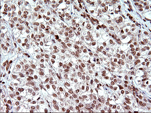 m17067 anti polr3gl mouse monoclonal antibody clone id oti5e8 ihc testing 21