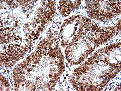 m17067 anti polr3gl mouse monoclonal antibody clone id oti5e8 ihc testing 4