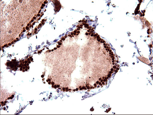 m17067 anti polr3gl mouse monoclonal antibody clone id oti5e8 ihc testing 5
