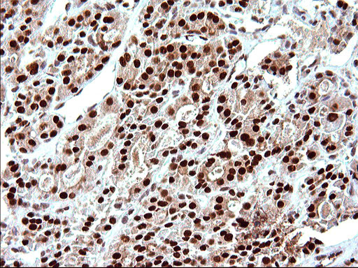 m17067 anti polr3gl mouse monoclonal antibody clone id oti5e8 ihc testing 6