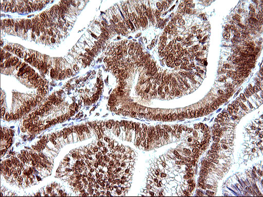 m17067 anti polr3gl mouse monoclonal antibody clone id oti5e8 ihc testing 8