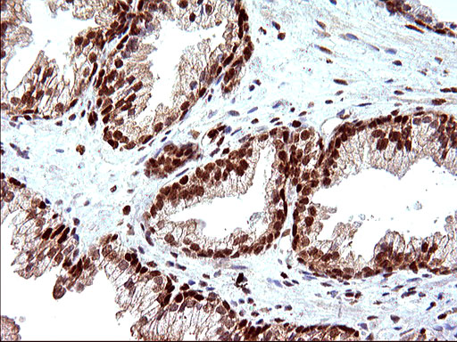 m17067 anti polr3gl mouse monoclonal antibody clone id oti5e8 ihc testing 9