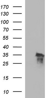 HEK293T cells were transfected with the pCMV6-ENTRY control (Left lane) or pCMV6-ENTRY POLR3GL (Right lane) cDNA for 48 hrs and lysed