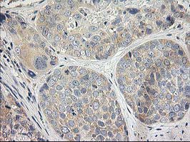 m17225 1 anti mds028 itfg2 mouse monoclonal antibody clone id oti3c4 ihc testing 4