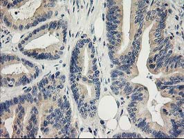 m17225 1 anti mds028 itfg2 mouse monoclonal antibody clone id oti3c4 ihc testing 5