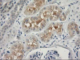 m17225 1 anti mds028 itfg2 mouse monoclonal antibody clone id oti3c4 ihc testing 6