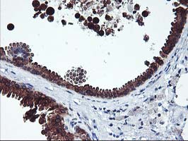 Immunohistochemical staining of paraffin-embedded Human breast tissue within the normal limits using anti-ITFG2 mouse monoclonal antibody