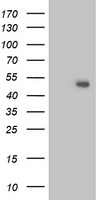 HEK293T cells were transfected with the pCMV6-ENTRY control (Left lane) or pCMV6-ENTRY ITFG2 (Right lane) cDNA for 48 hrs and lysed