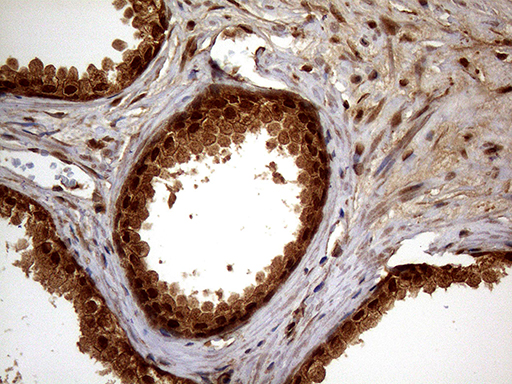 Immunohistochemical staining of paraffin-embedded Human prostate tissue within the normal limits using anti-SPANXN3 mouse monoclonal antibody