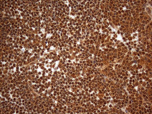 m17405 anti spanxn3 mouse monoclonal antibody clone id oti1a2 ihc testing 4