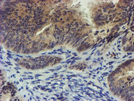 m17411 anti tigd1 mouse monoclonal antibody clone id oti4g9 ihc testing 2