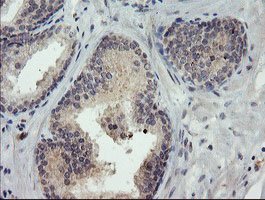 m17411 anti tigd1 mouse monoclonal antibody clone id oti4g9 ihc testing 3
