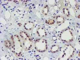 m17411 anti tigd1 mouse monoclonal antibody clone id oti4g9 ihc testing 4