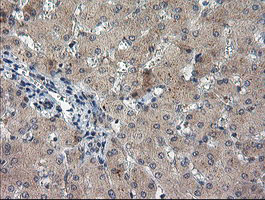 m17411 anti tigd1 mouse monoclonal antibody clone id oti4g9 ihc testing 5