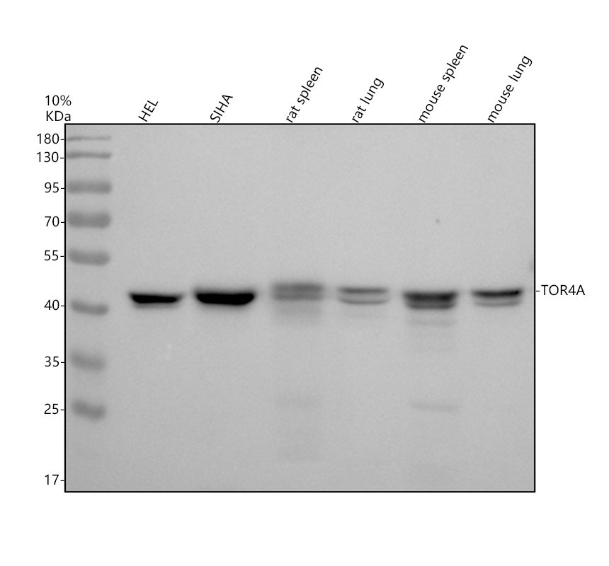 Western blot analysis of TOR4A using anti-TOR4A antibody (M17448)