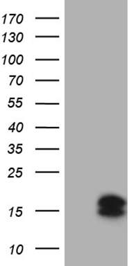HEK293T cells were transfected with the pCMV6-ENTRY control (Left lane) or pCMV6-ENTRY CSAG2 (Right lane) cDNA for 48 hrs and lysed. Equivalent amounts of cell lysates (5 ug per lane) were separated by SDS-PAGE and immunoblotted with anti-CSAG2 (1:500).
