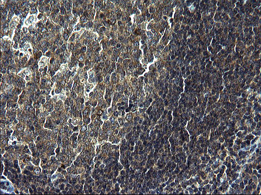 Immunohistochemical staining of paraffin-embedded Human lymph node tissue within the normal limits using anti-C12orf26 mouse monoclonal antibody