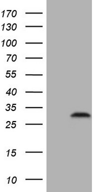 HEK293T cells were transfected with the pCMV6-ENTRY control (Left lane) or pCMV6-ENTRY C3orf43 (Right lane) cDNA for 48 hrs and lysed