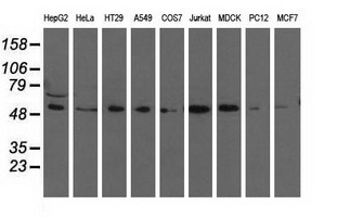 m18041 anti tcp11l2 mouse monoclonal antibody clone id oti2a10 wb testing 2
