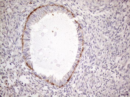 m18084 anti poteg mouse monoclonal antibody clone id oti2g1 ihc testing 2