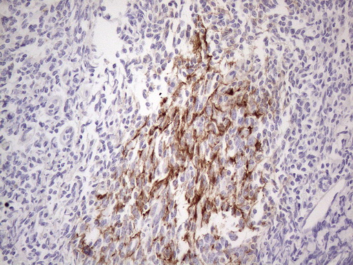 m18084 anti poteg mouse monoclonal antibody clone id oti2g1 ihc testing 4