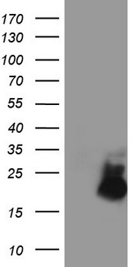 HEK293T cells were transfected with the pCMV6-ENTRY control (Left lane) or pCMV6-ENTRY AVPI1 (Right lane) cDNA for 48 hrs and lysed. Equivalent amounts of cell lysates (5 ug per lane) were separated by SDS-PAGE and immunoblotted with anti-AVPI1.