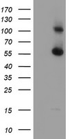HEK293T cells were transfected with the pCMV6-ENTRY control (Left lane) or pCMV6-ENTRY RBM46 (Right lane) cDNA for 48 hrs and lysed