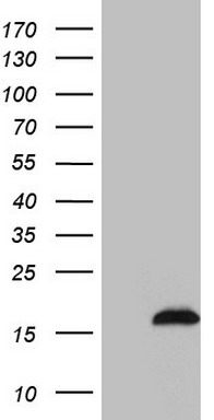 HEK293T cells were transfected with the pCMV6-ENTRY control (Left lane) or pCMV6-ENTRY SAMD12 (Right lane) cDNA for 48 hrs and lysed. Equivalent amounts of cell lysates (5 ug per lane) were separated by SDS-PAGE and immunoblotted with anti-SAMD12 (1:2000).